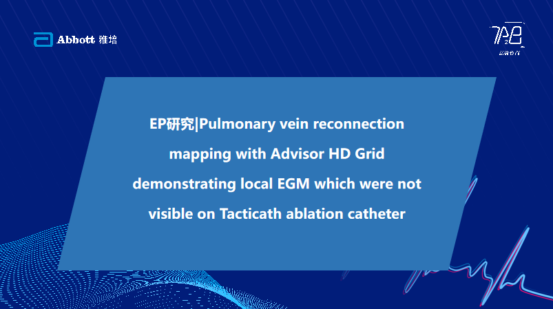 EP研究|Pulmonary vein reconnection mapping with Advisor HD Grid demonstrating local EGM which were not visible on Tacticath ablation catheter